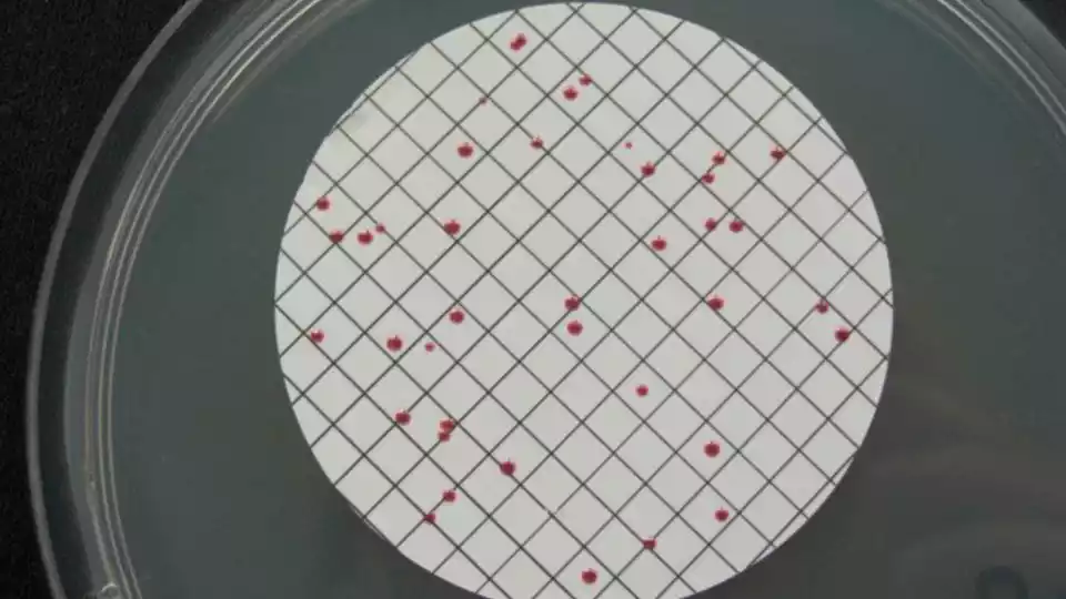 Enterococos. Vista microscópica